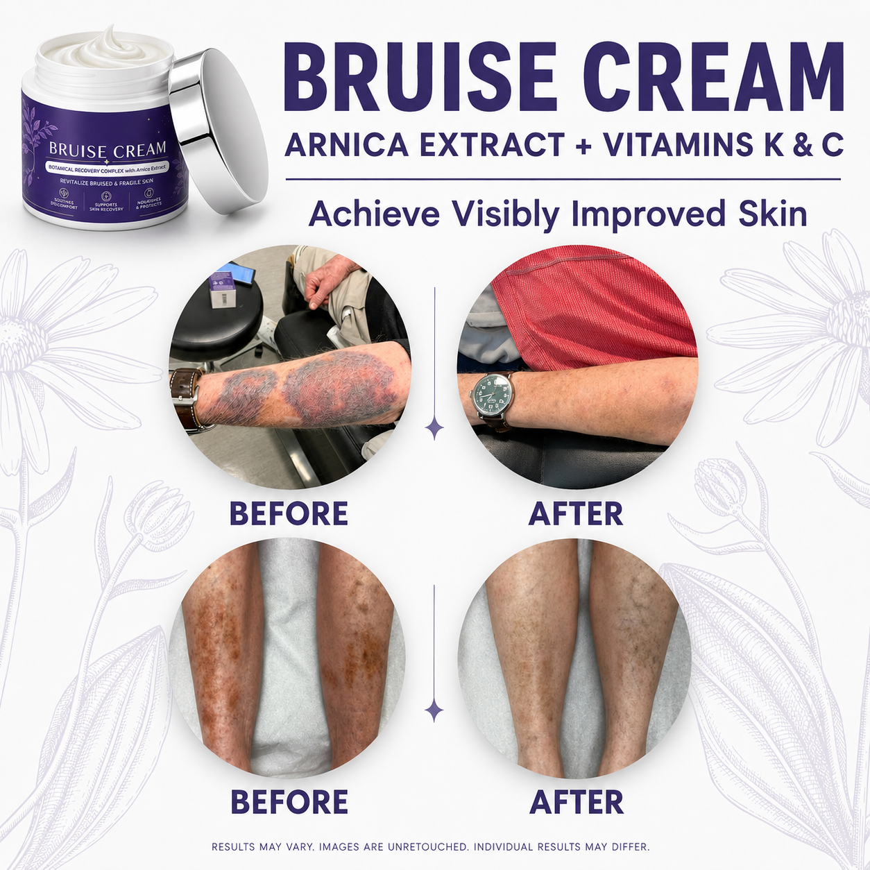 🌼🌼🌼🌼 Completely eliminates bruises, removes body contusions and various scars, deeply repairs damaged skin, reduces swelling and discomfort, and restores healthy skin.