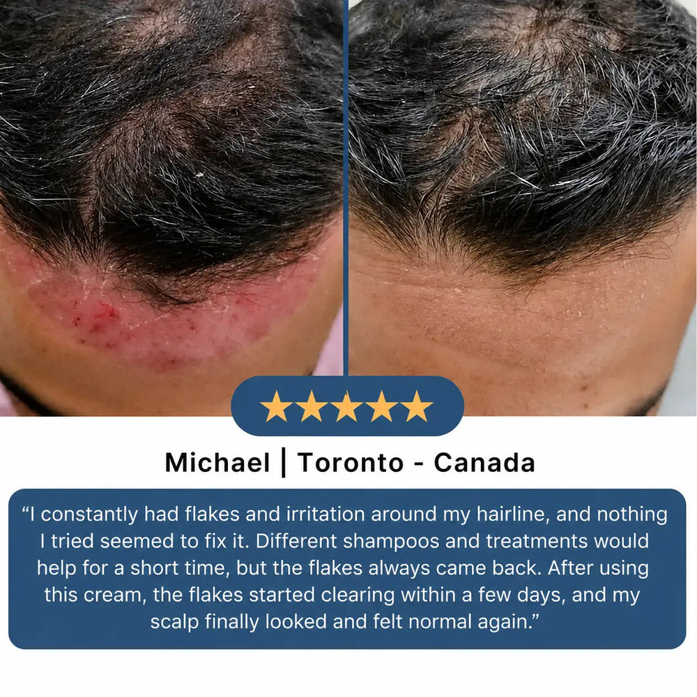 A more comfortable-looking scalp