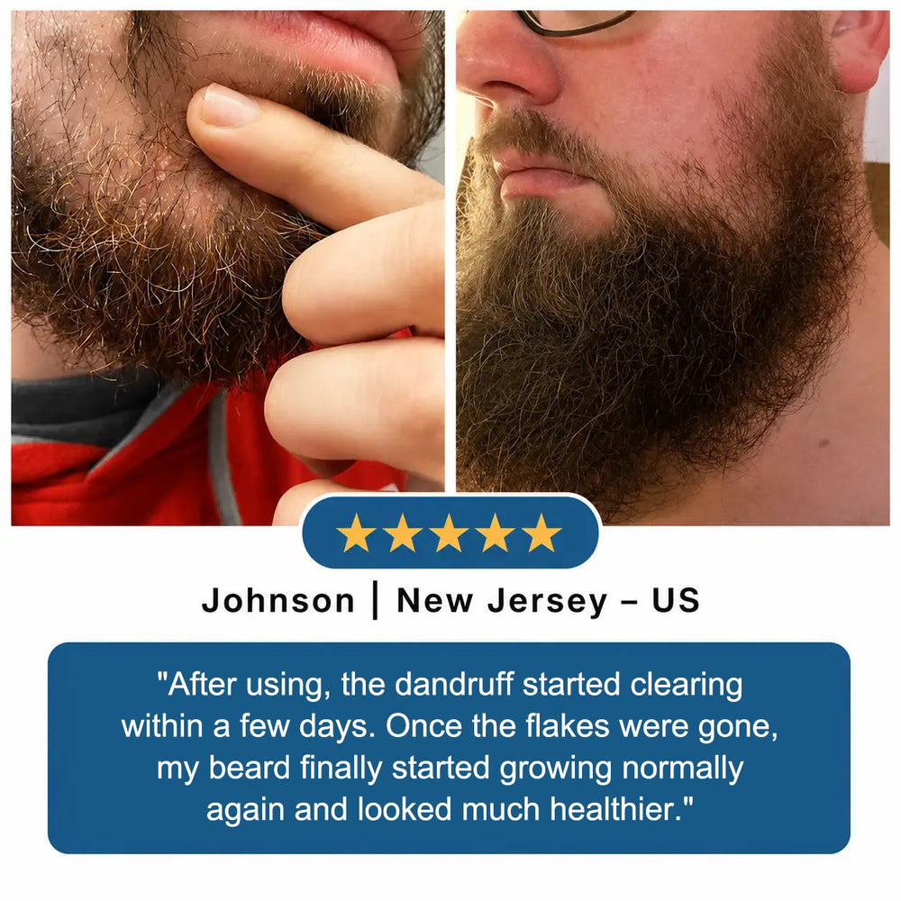 A cleaner, calmer-looking beard area