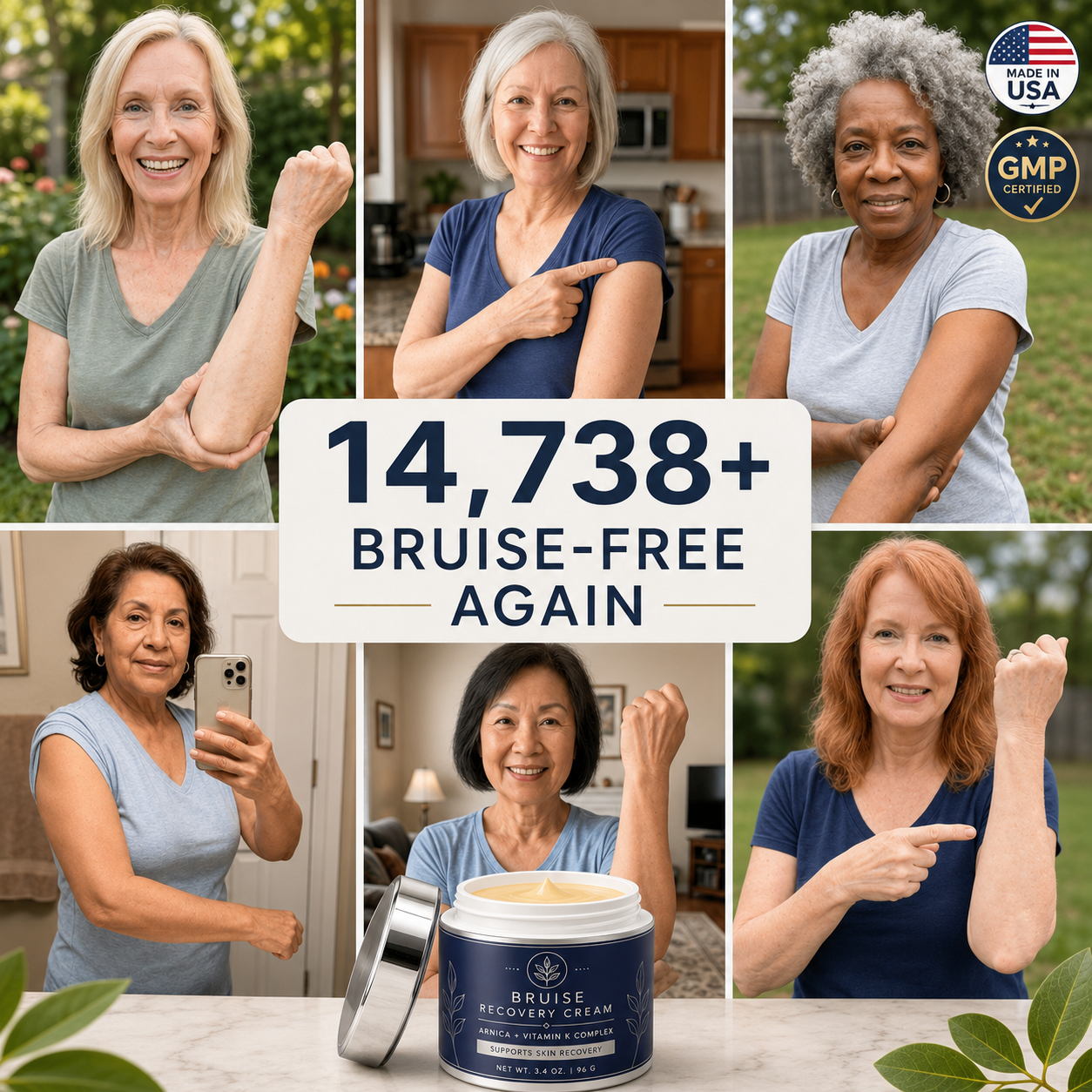 Collage of mature women showing their forearms with Bruise Recovery Cream