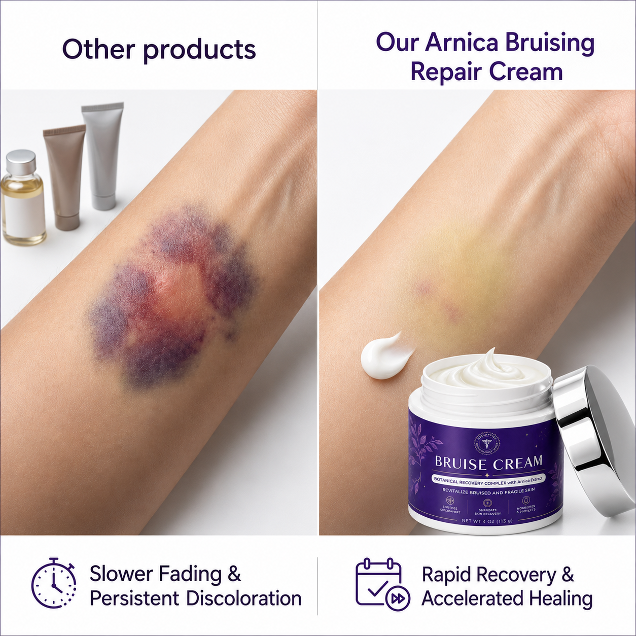 🌼🌼🌼🌼 Completely eliminates bruises, removes body contusions and various scars, deeply repairs damaged skin, reduces swelling and discomfort, and restores healthy skin.