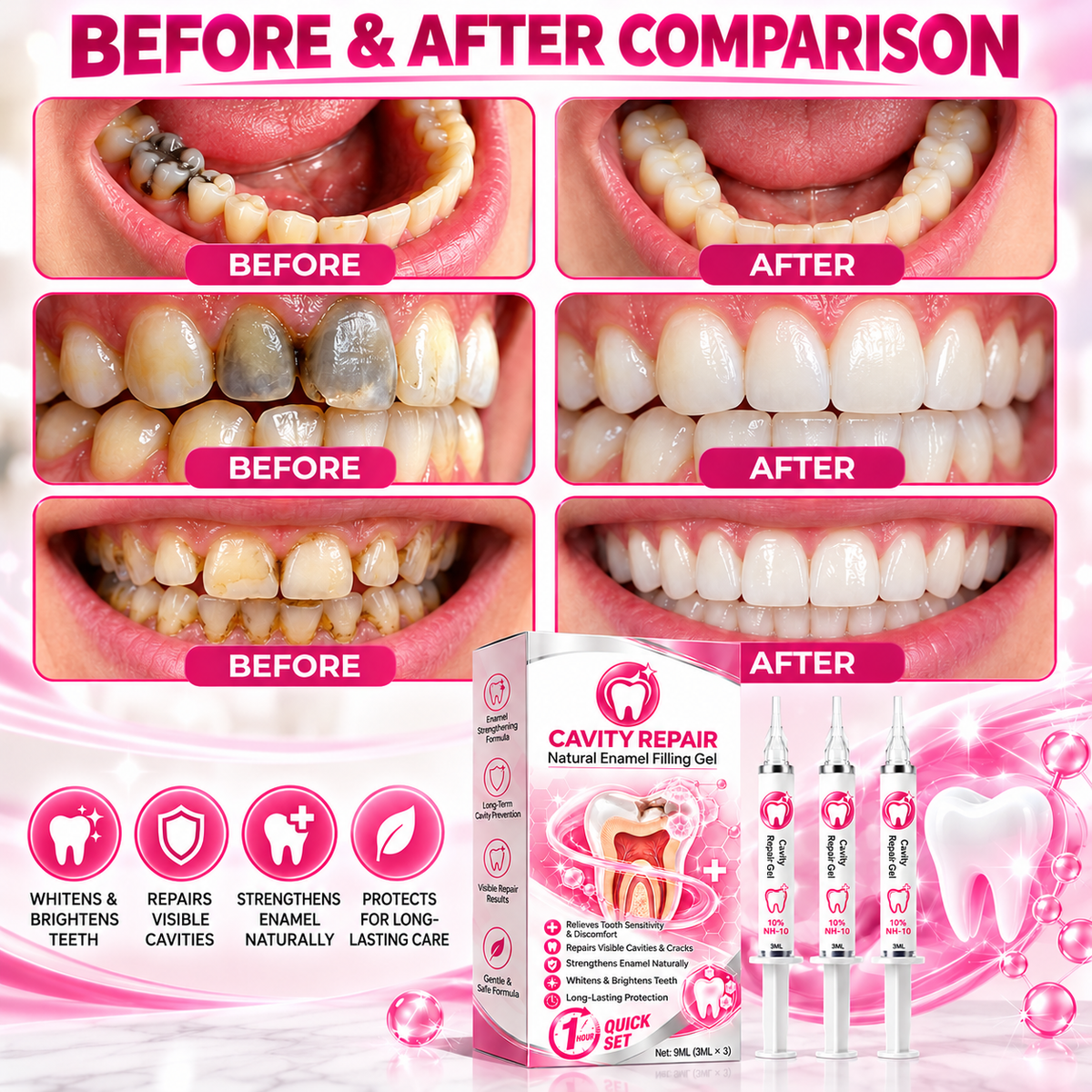 Second before and after teeth comparison graphic with gel