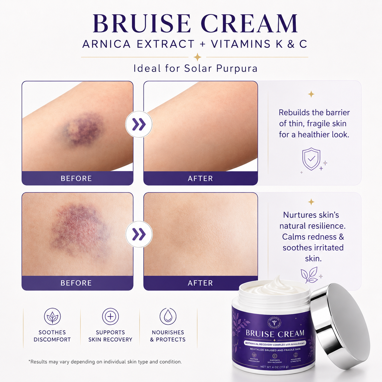 🌼🌼🌼🌼 Completely eliminates bruises, removes body contusions and various scars, deeply repairs damaged skin, reduces swelling and discomfort, and restores healthy skin.