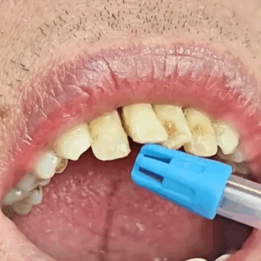 Foaming toothpaste one press experience