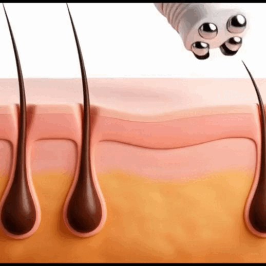 Deoxyribose Scalp Serum application animation