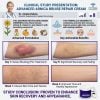 🌼🌼🌼🌼 Completely eliminates bruises, removes body contusions and various scars, deeply repairs damaged skin, reduces swelling and discomfort, and restores healthy skin.