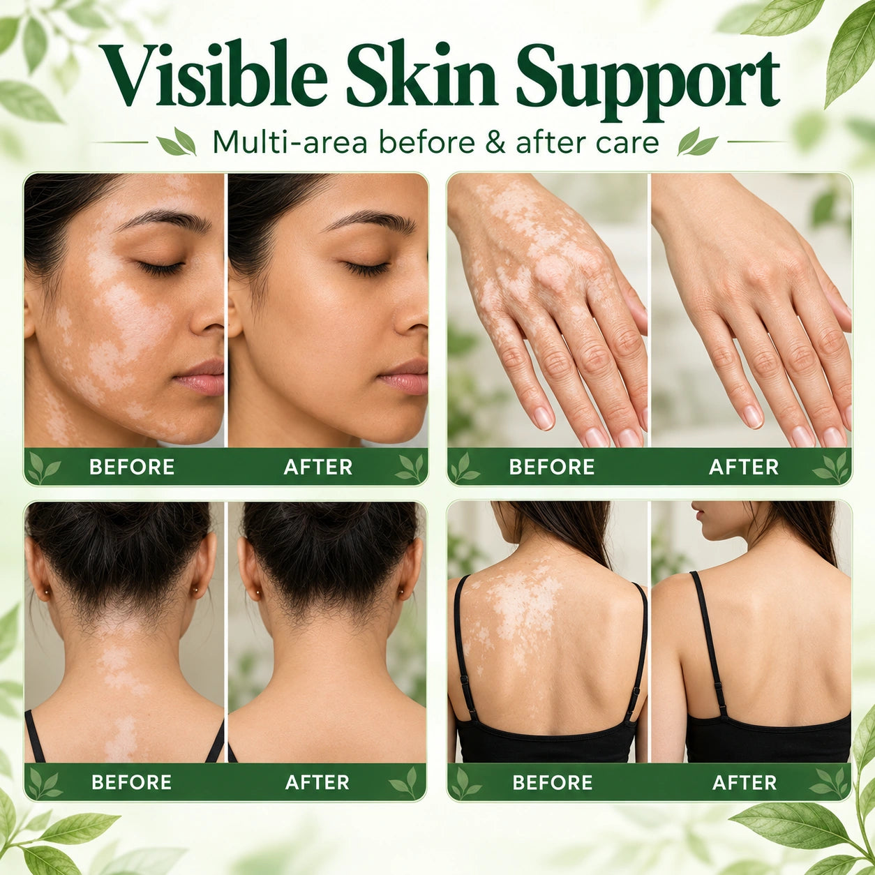 Illustrative paired skin-appearance images of face, hands, neck and back